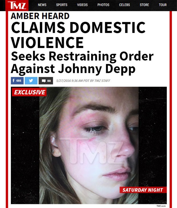Site TMZ mostra imagem de Amber Heard com hematoma que teria sido provocado por seu marido, Johnny Depp, com um iPhone (Foto: Reprodução/TMZ)